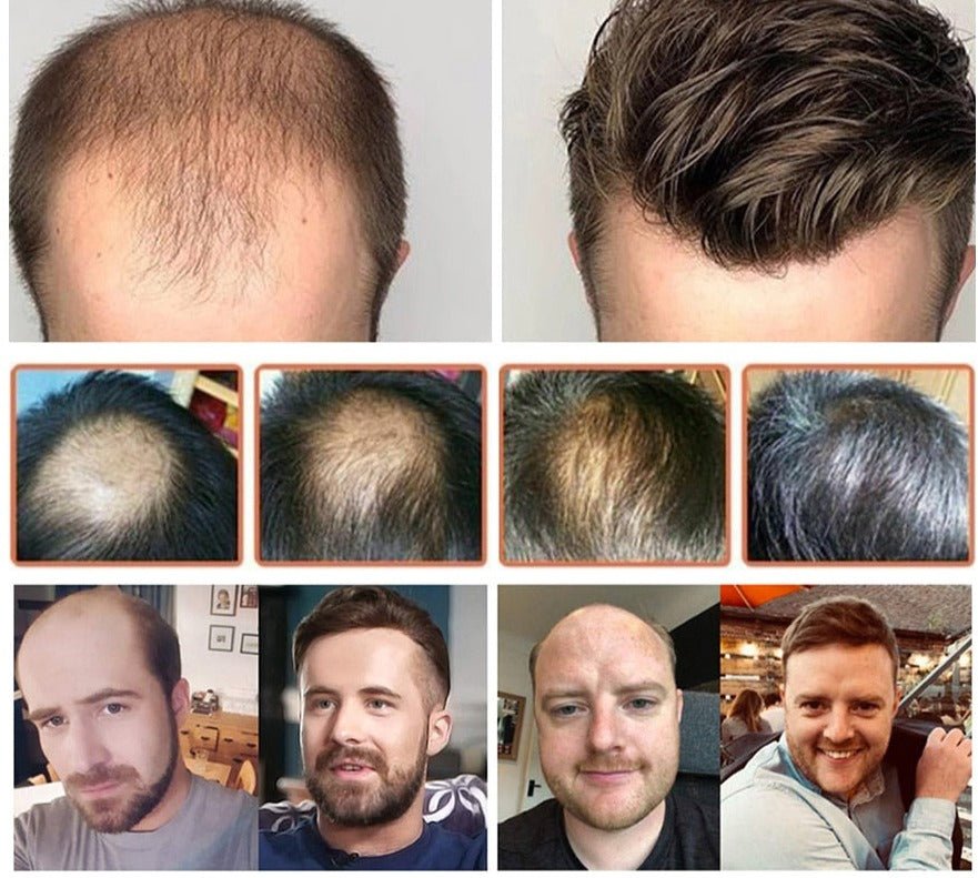 Prosthesis 100% Indian Human Hair Replacement System Toupee - HairNjoy