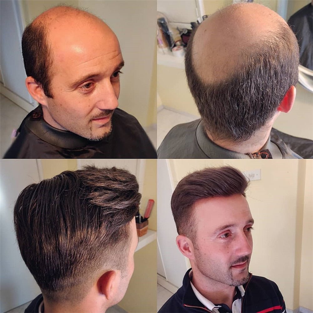 Prosthesis 100% Indian Human Hair Replacement System Toupee - HairNjoy